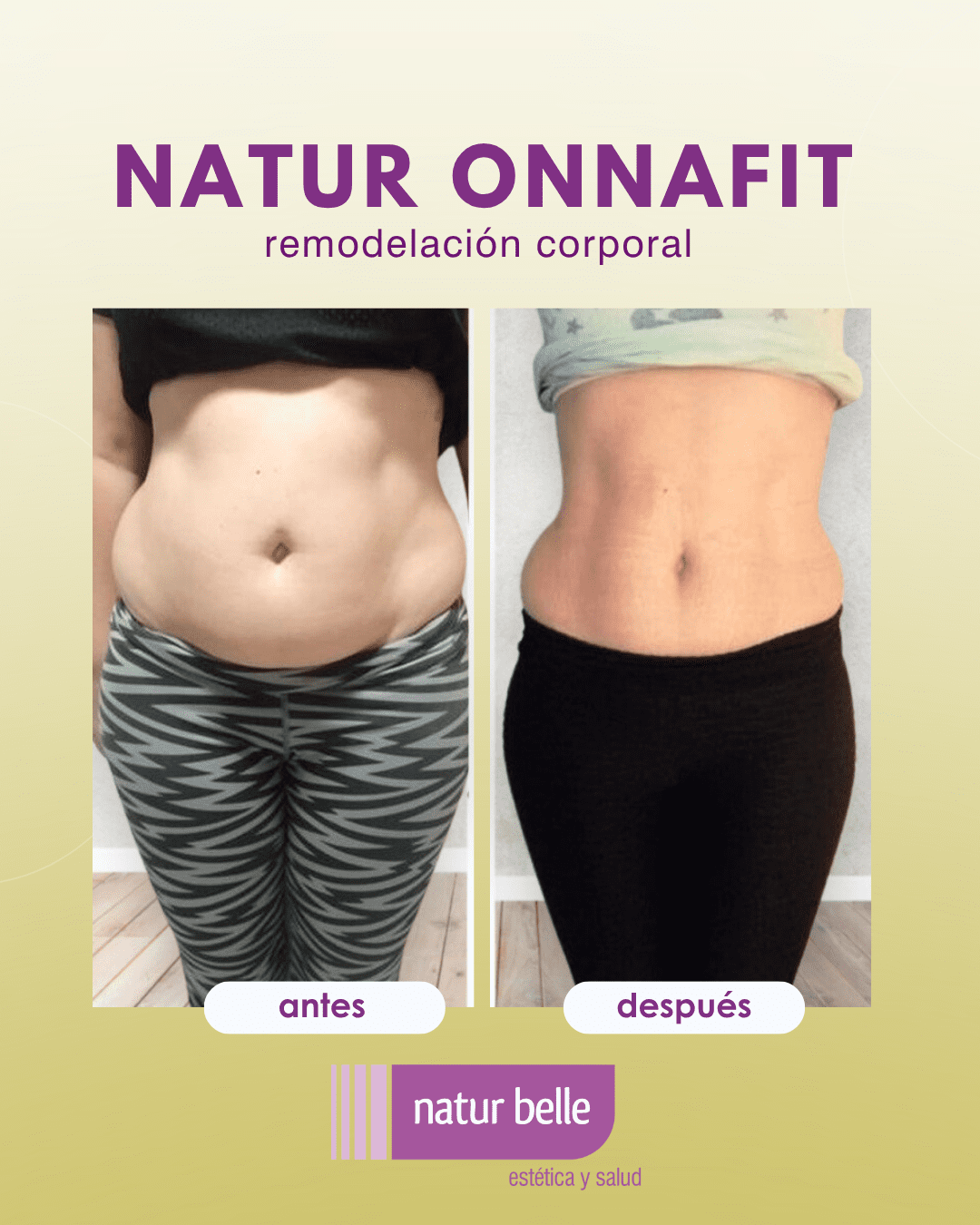 natur onnafit antes y después 3