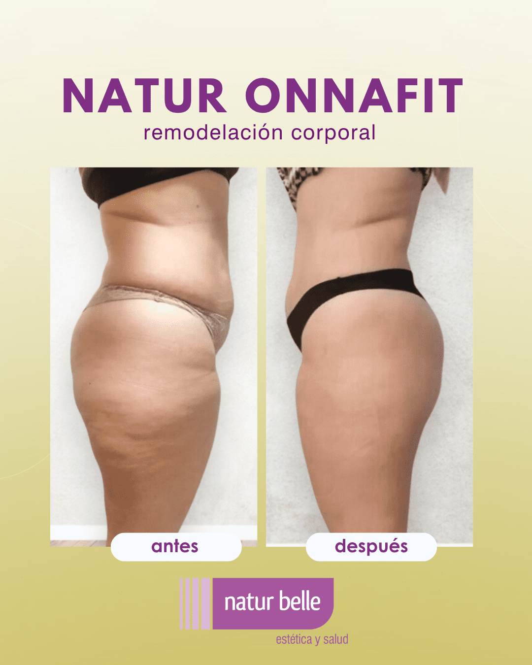 natur onnafit antes y después 1